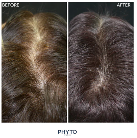 PHYTOCYANE Anti-Hair Thinning Dietary Supplement (12-Week Supply)