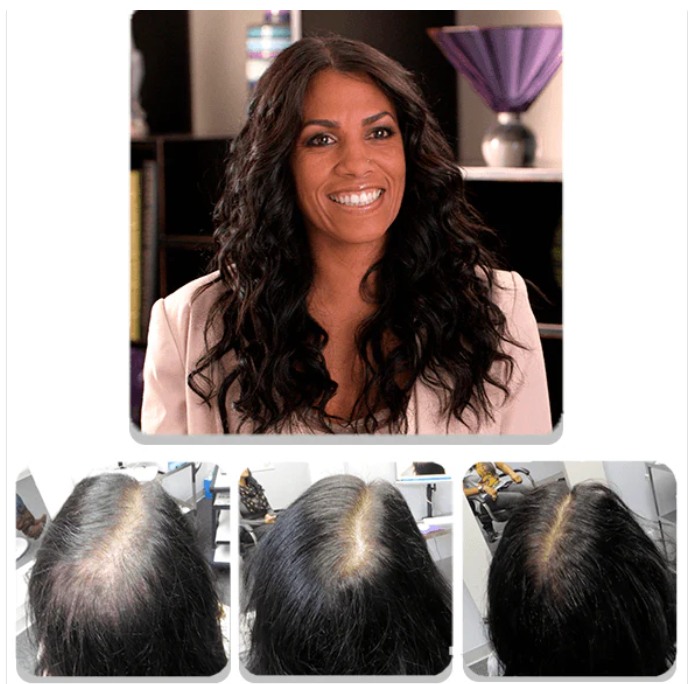 HAIR REGROWTH SYSTEM FOR WOMEN