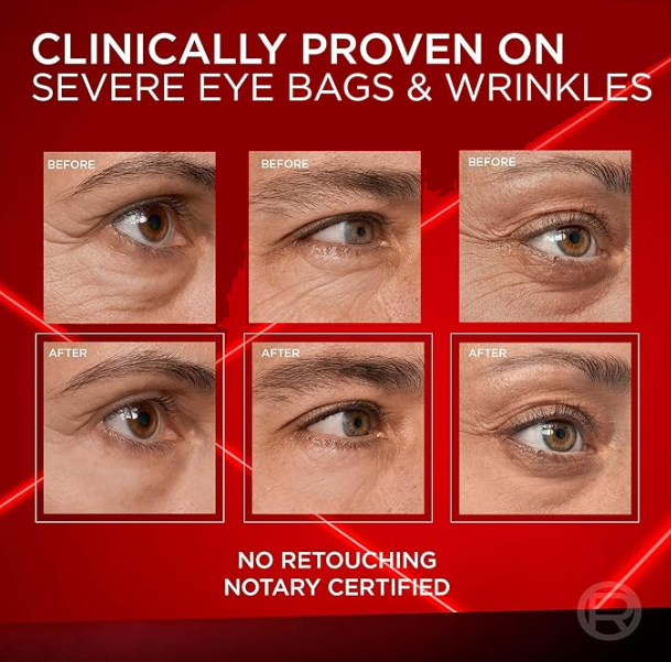 Eye Serum for dark circles
