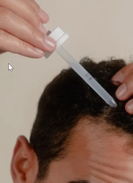 Minoxidil Solution, 5%