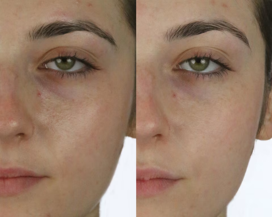 The Dewy Skin Cream - Limited Edition