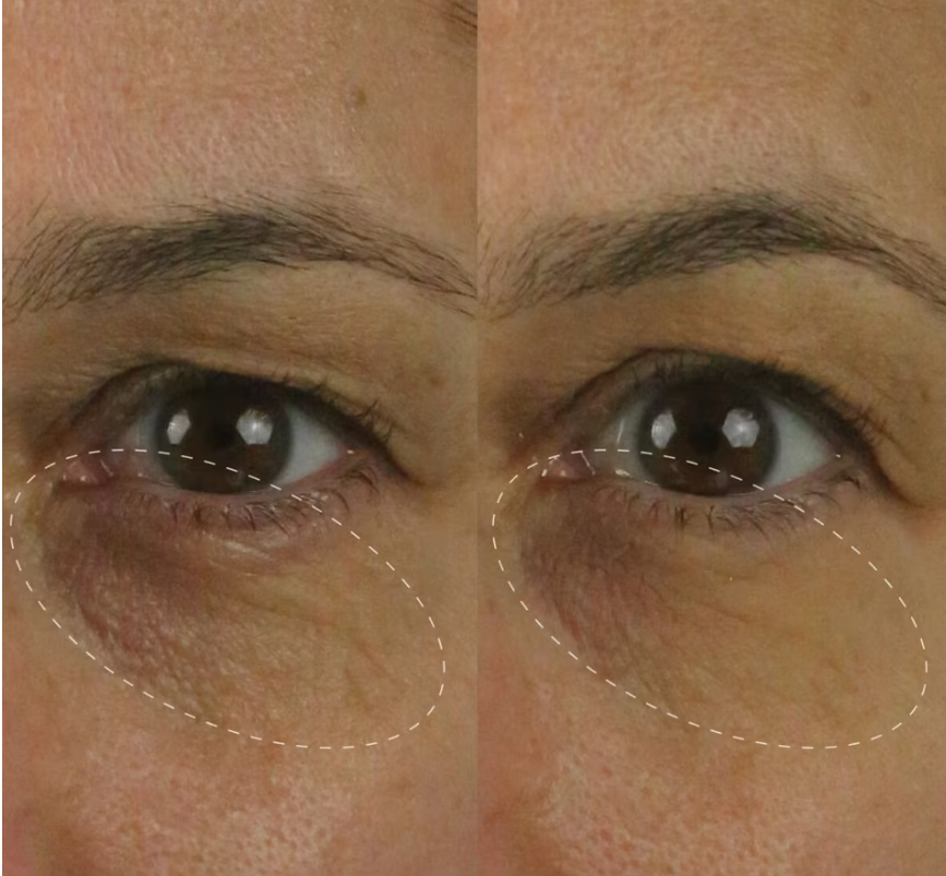 The Brightening Eye Cream
